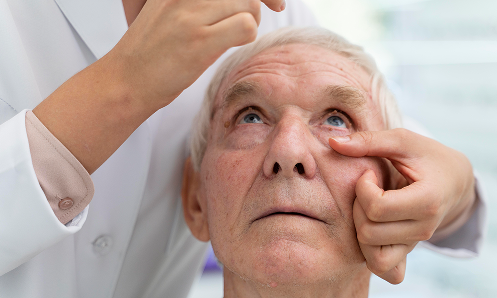GLAUCOMA